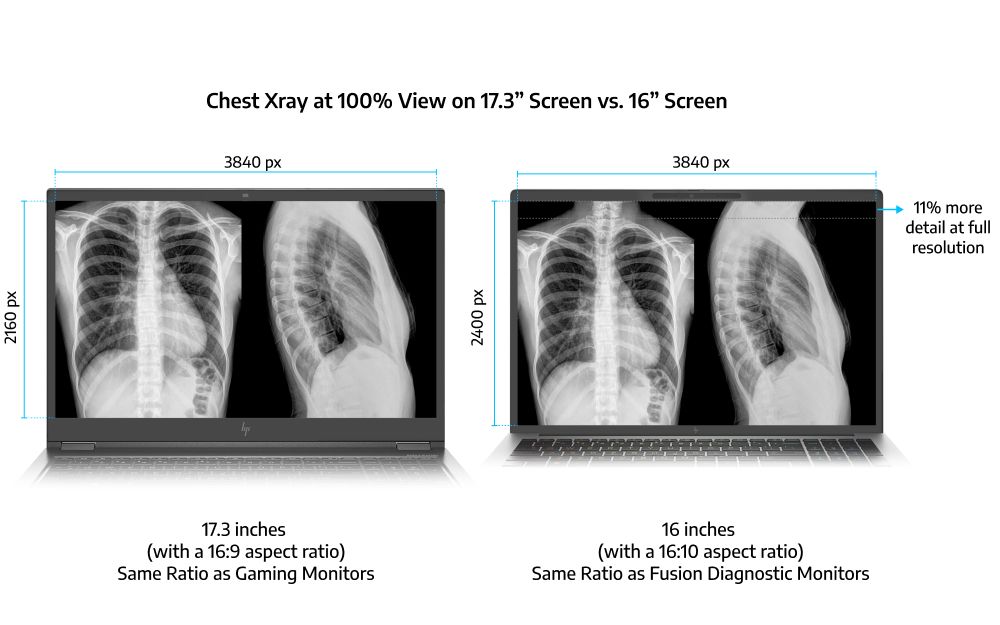 Why 16-Inch Displays with a Taller Aspect Ratio are Better for Radiologists than Traditional 17.3-Inch Screens