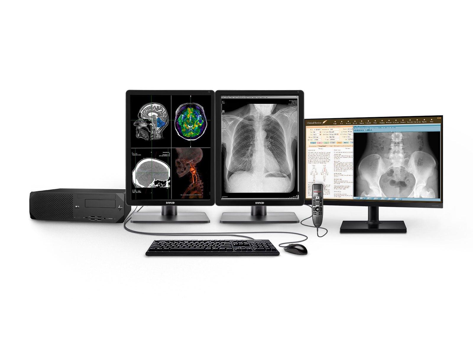 Complete PACS General Radiology Station | Barco Nio 2MP Color LED Display | HP Workstation | Dictation Mic | Worklist Monitor (2221Z2N)