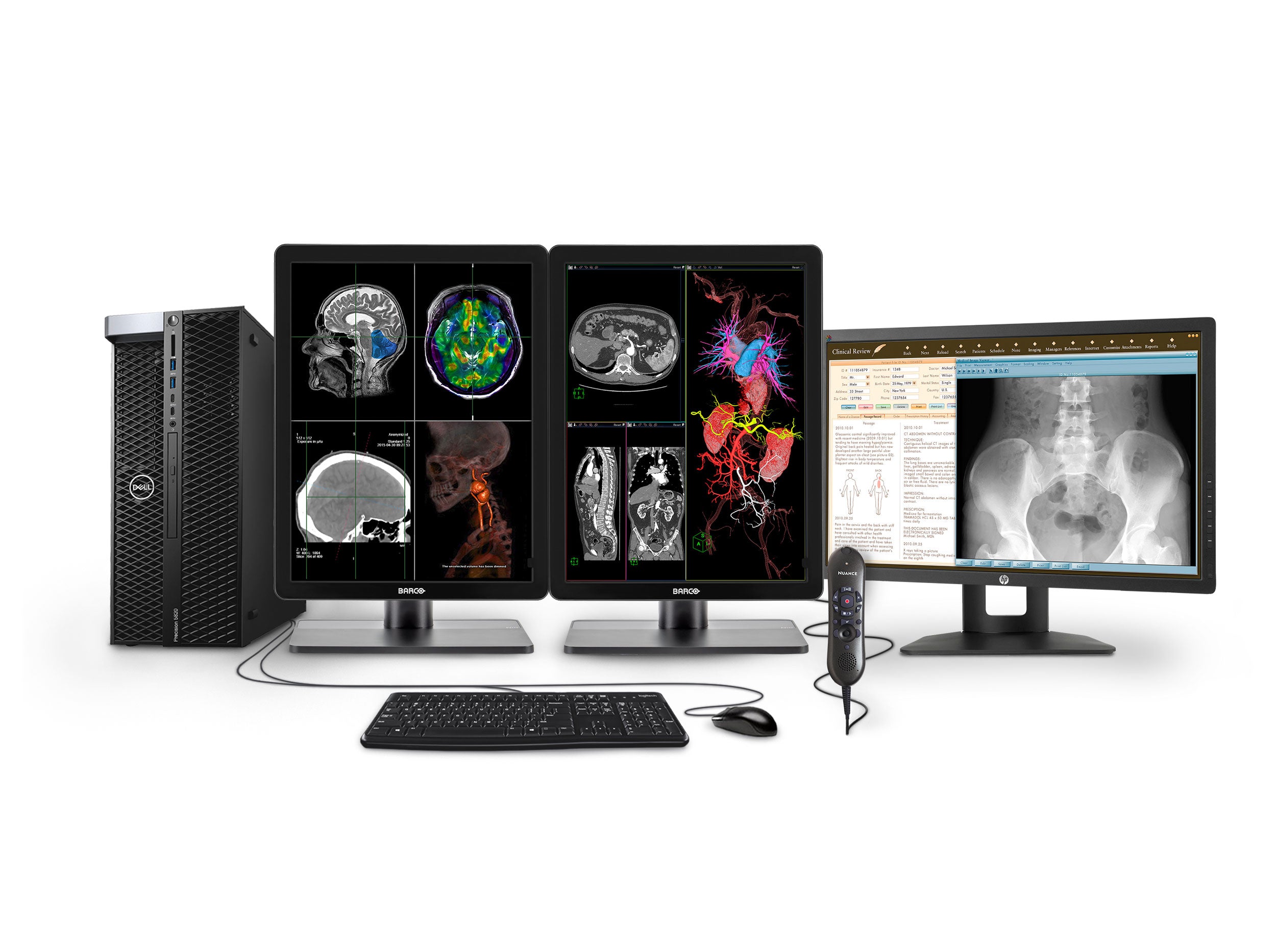 Complete PACS General Radiology Station | Barco 3MP Color LED Displays | Dell Workstation | Dictation Mic | Worklist Monitor (3421P520) Monitors.com 