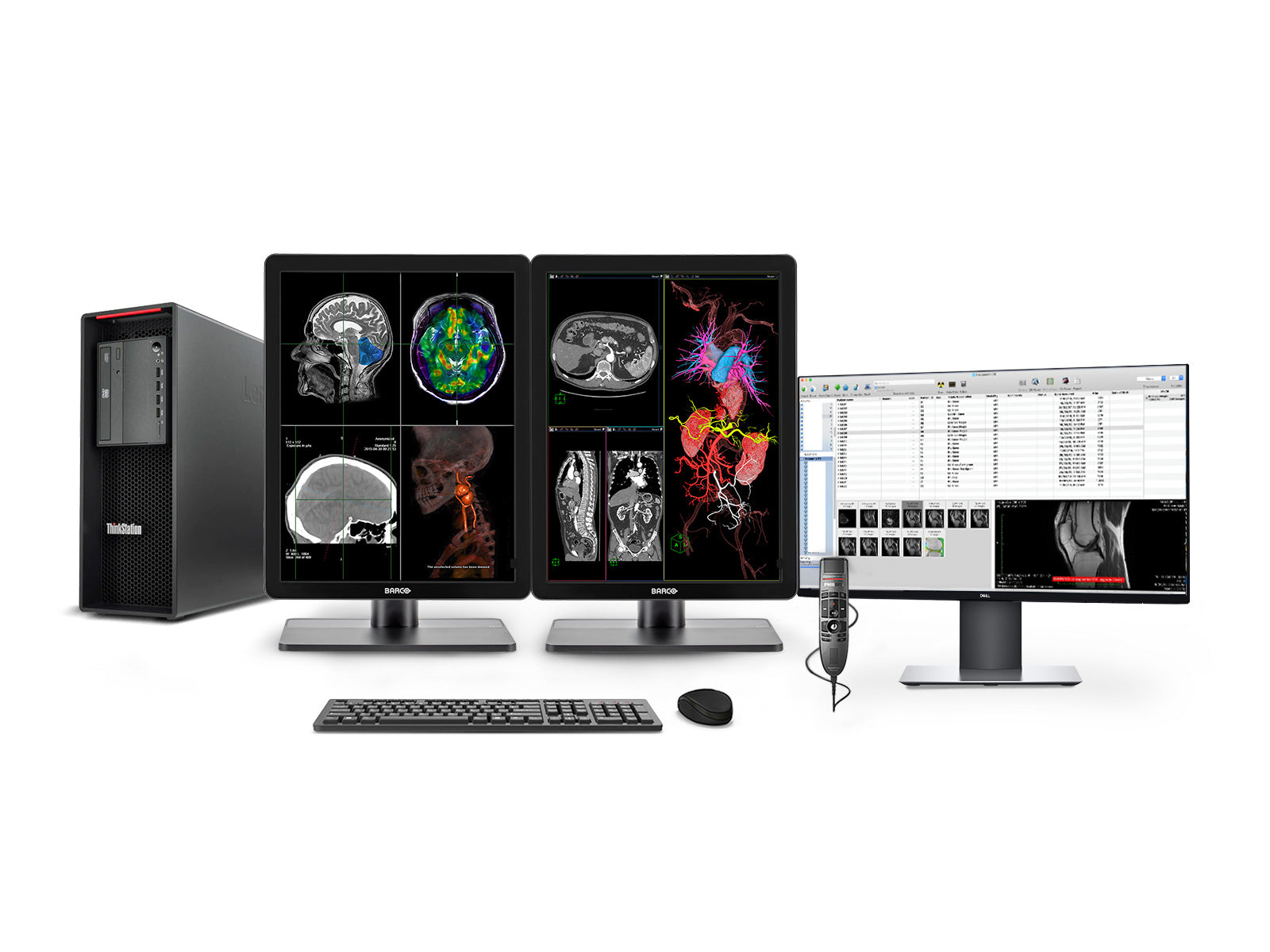 Complete PACS General Radiology Station | Barco Nio MDNC-3421 3MP Color LED Displays | Lenovo Workstation | Dictation Mic | Worklist Monitor (3421Z4R)