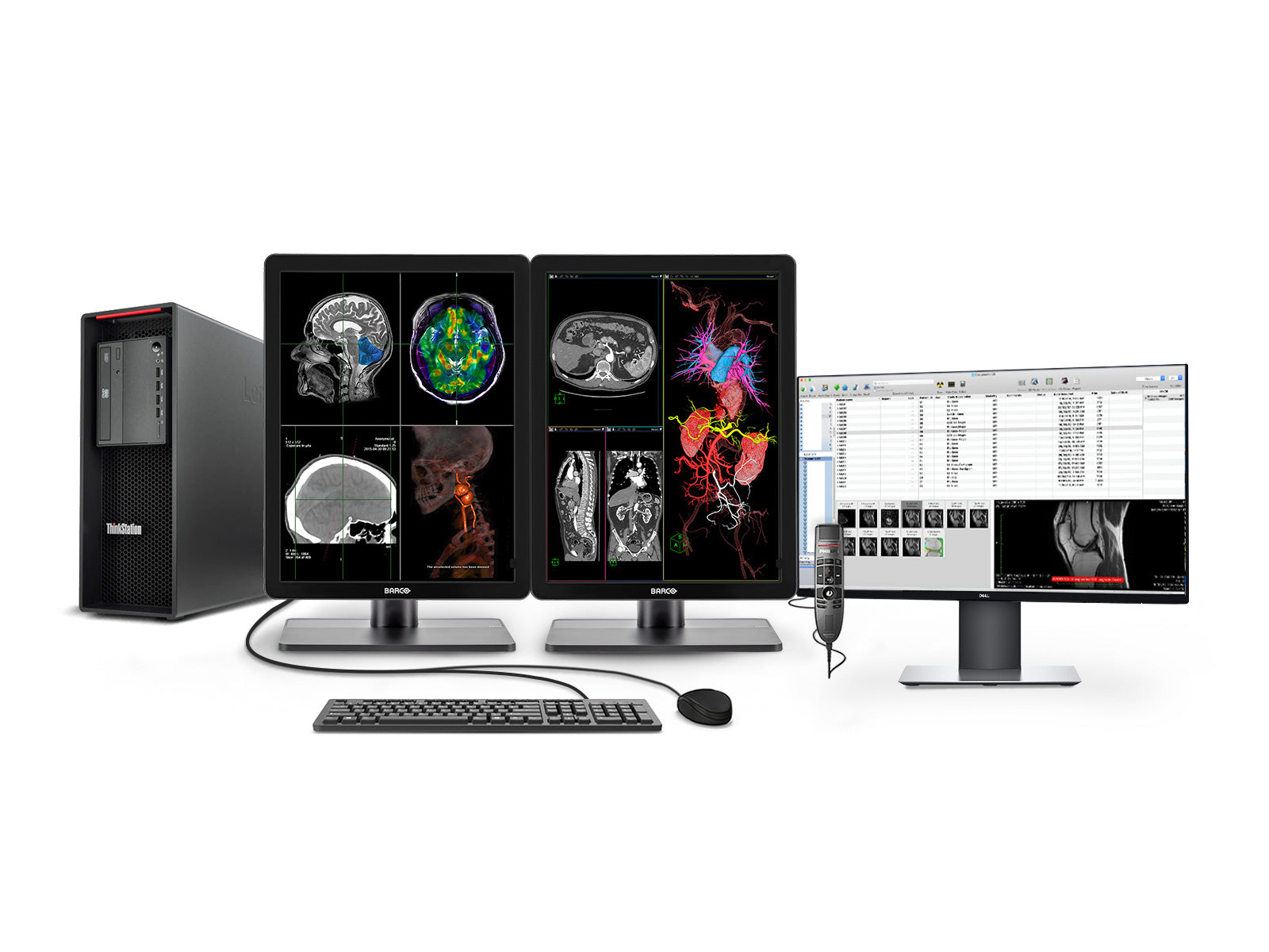 Complete PACS General Radiology Station | Barco Nio MDNC-3421 3MP Color LED Displays | Lenovo Workstation | Dictation Mic | Worklist Monitor (3421Z4R)