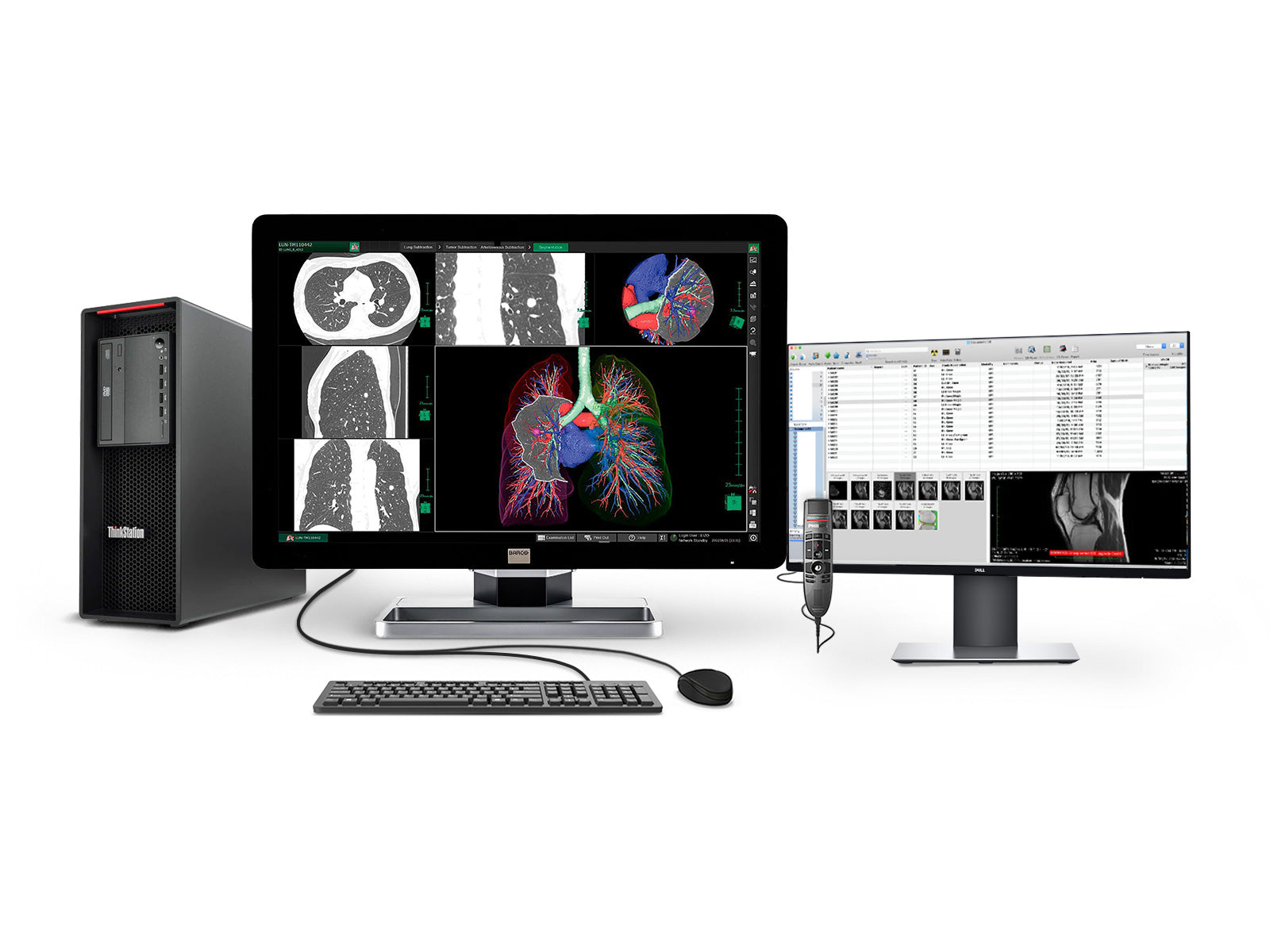 Complete PACS General Radiology Station | Barco 6MP MDCC-6130 Color LCD Display | Lenovo Workstation | Dictation Mic | Worklist Monitor (6130Z4)