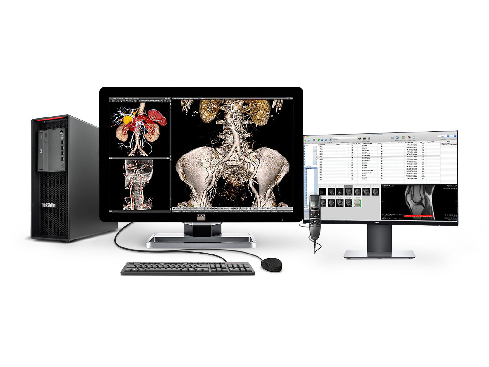 Complete PACS General Radiology Station | Barco 6MP MDCC-6230 Display | Lenovo Workstation | Dictation Mic | Worklist Monitor (6230Z4R)