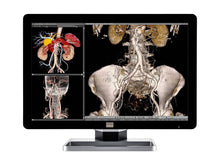 Barco Coronis Fusion MDCC-6230 Display PACS per radiologia generale a LED da 6 MP 30" a colori