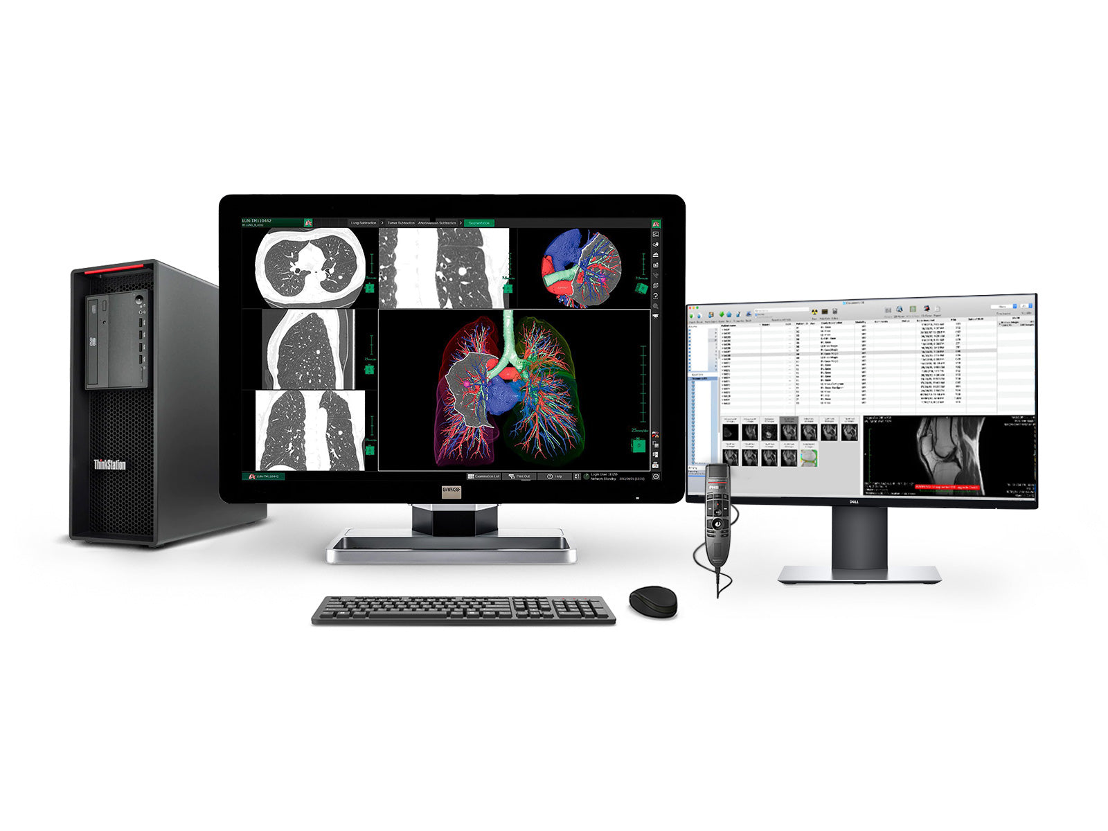Complete PACS General Radiology Station | Barco Coronis MDCC-6330 6MP Color LED Display | Lenovo Workstation | Dictation Mic | Worklist Monitor (6330Z4R)