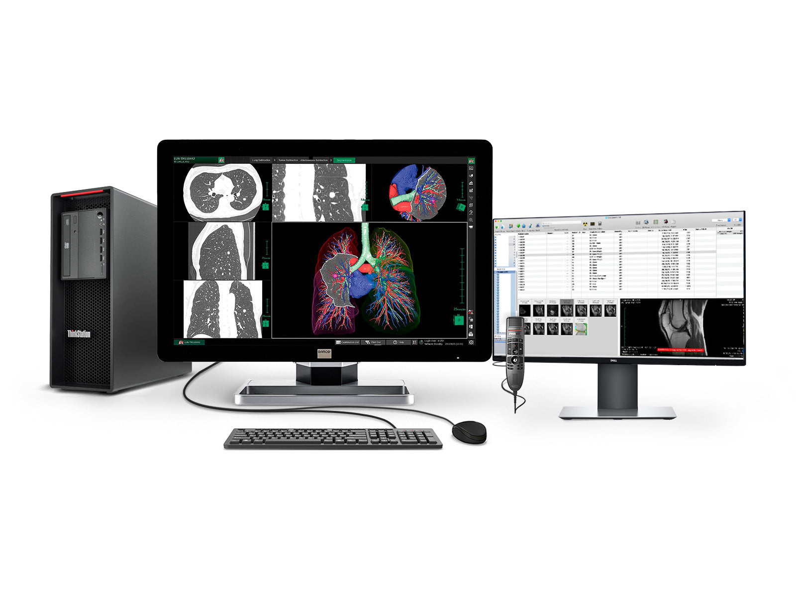 Complete PACS General Radiology Station | Barco Coronis MDCC-6330 6MP Color LED Display | Lenovo Workstation | Dictation Mic | Worklist Monitor (6330Z4R)