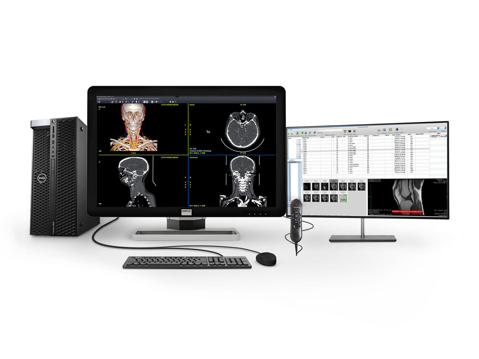 Barco General Radiology Reading Station | Coronis 6MP MDCC-6430 | Dell i9 Workstation | Nuance Mic | 24" Worklist Monitors (64305820)