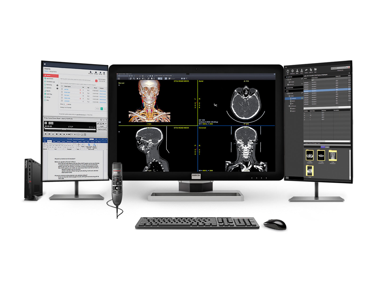 Barco Coronis Fusion MDCC‑6430 6MP 30″ Radiology PACS Display + Lenovo ThinkStation P3 Tiny i9‑14900 64GB DDR5 Workstation + Philips SpeechMike Trackball Dictation Mic + Dual 24″ HD Worklist Monitors + Barco MXRT‑4700 GPU + Lenovo Keyboard & Mouse
