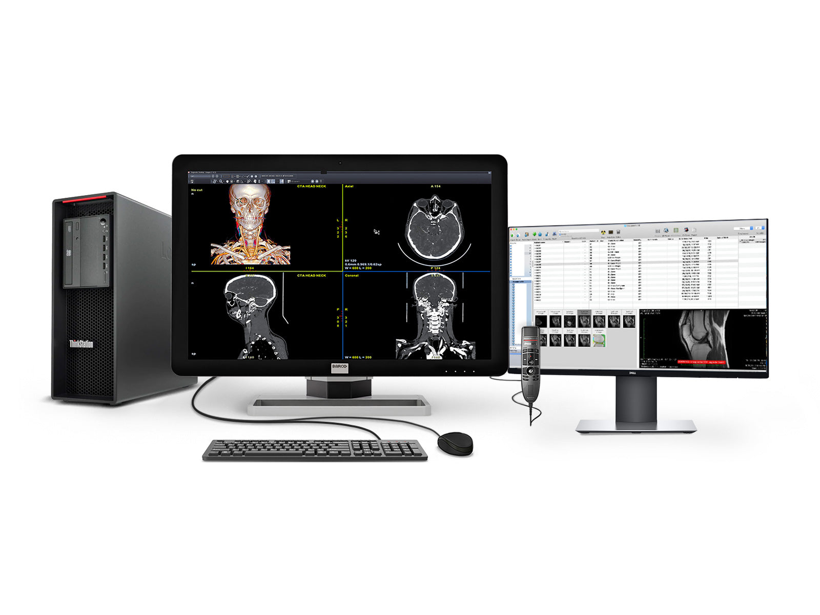 Complete PACS General Radiology Reading Station | Barco 6MP MDCC-6430 | Lenovo Workstation | Nuance Mic | 24" Worklist Monitors (6430Z4R)