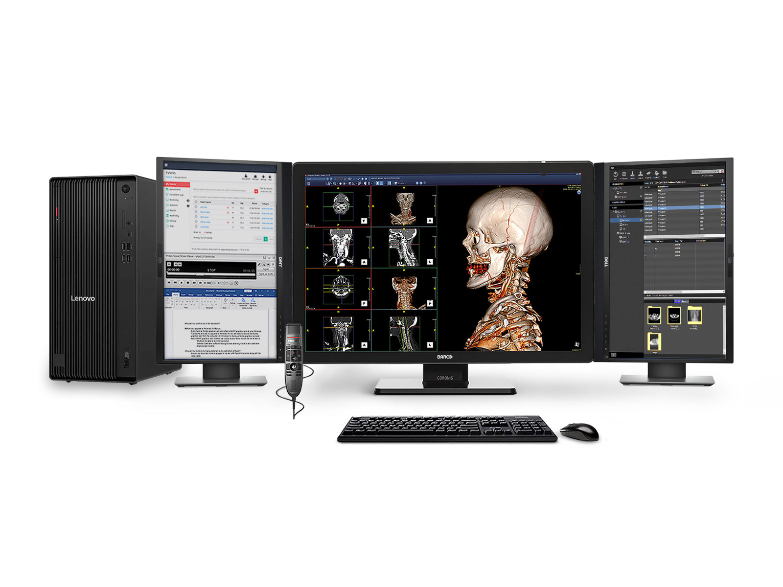 パナソニック　モニター　cv-mdc543 Complete PACS General Radiology Station - Lenovo Workstation