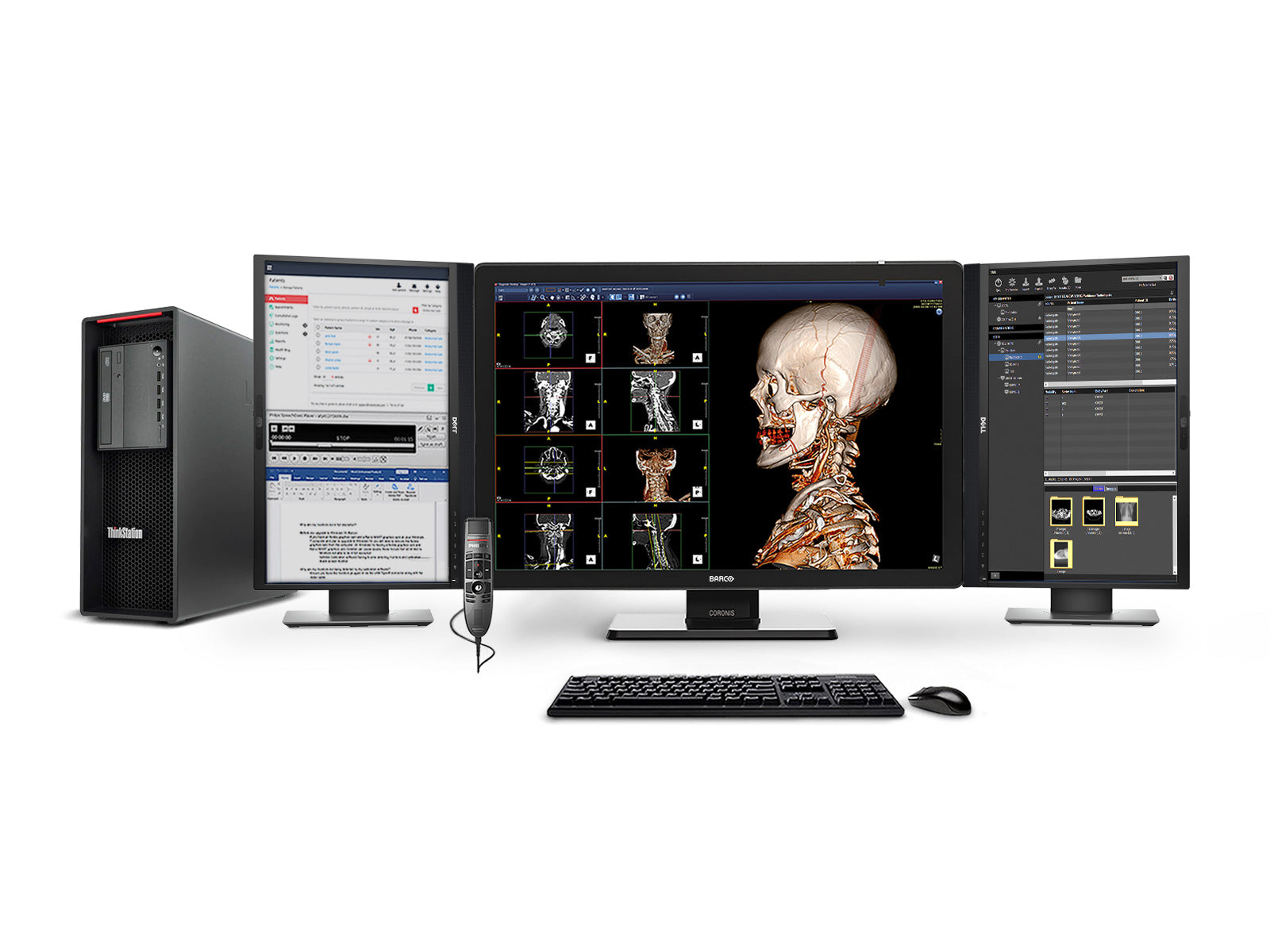Complete PACS General Radiology Station | Barco Coronis MDCC-6530 6MP Color LED Display | Lenovo Workstation | Dictation Mic | Worklist Monitor (6530Z4R)