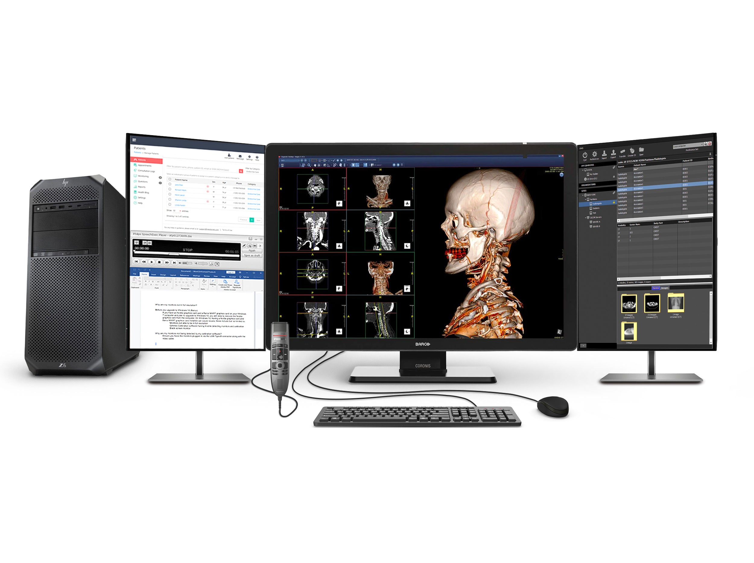 Complete PACS General Radiology Station | Barco 6MP Color LED Display | HP Workstation | Dictation Mic | Worklist Monitor (6530Z6G4)