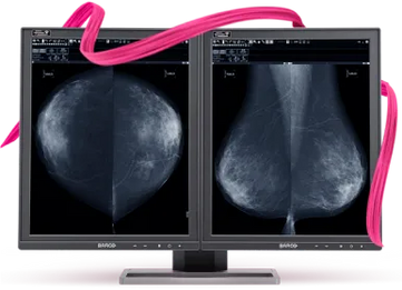 Barco 5MP Tomo Mammo Display