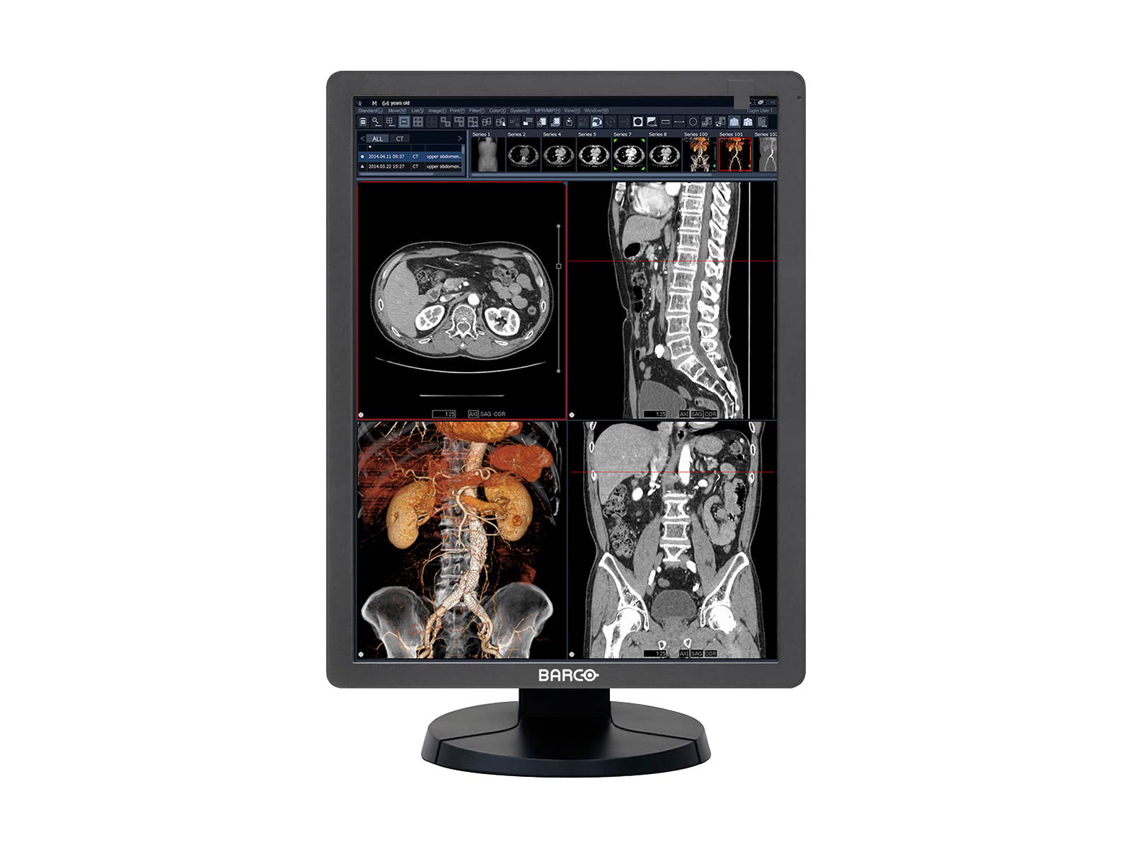 Barco Eonis MDRC-2321 2MP 21" SNIB HLX Color Clinical Review Display Monitors.com 