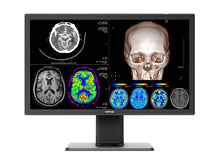 Barco 27" 4K 8MP Monitor Medico per Radiologia Diagnostica MDPC‑8127 (K9610269)