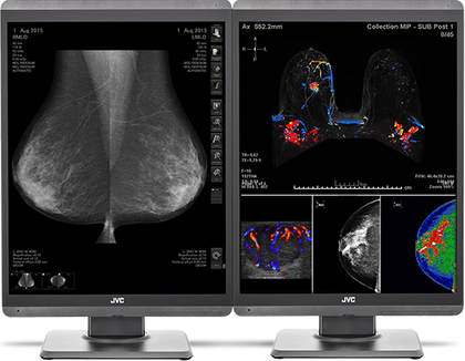 JVC 5MP  Mammography Display
