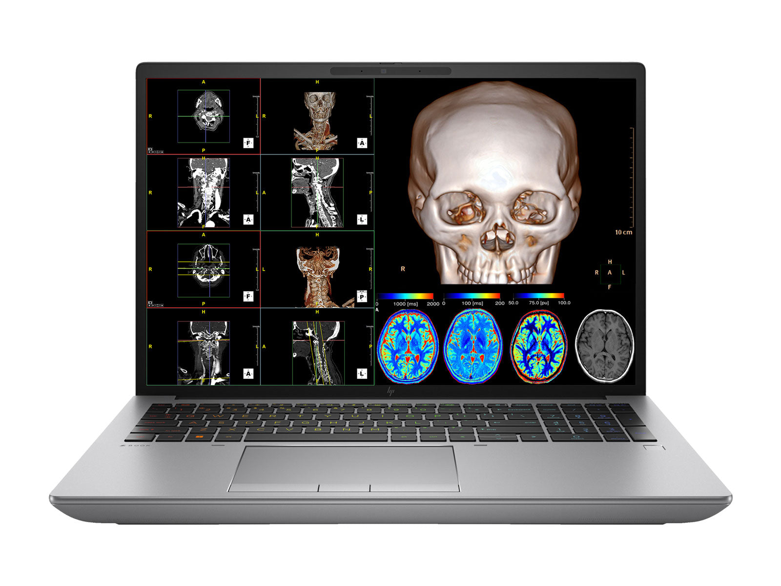 HP ZBook Fury 16 G10 Mobile Radiology Workstation | 16" 9MP 4K+ UHD DICOM Calibrated | Core i9-13950HX @ 5.50GHz | 24-Core | 128GB DDR5 | 1TB NVMe SSD | RTX 3500 Ada 12GB | WiFi 6E