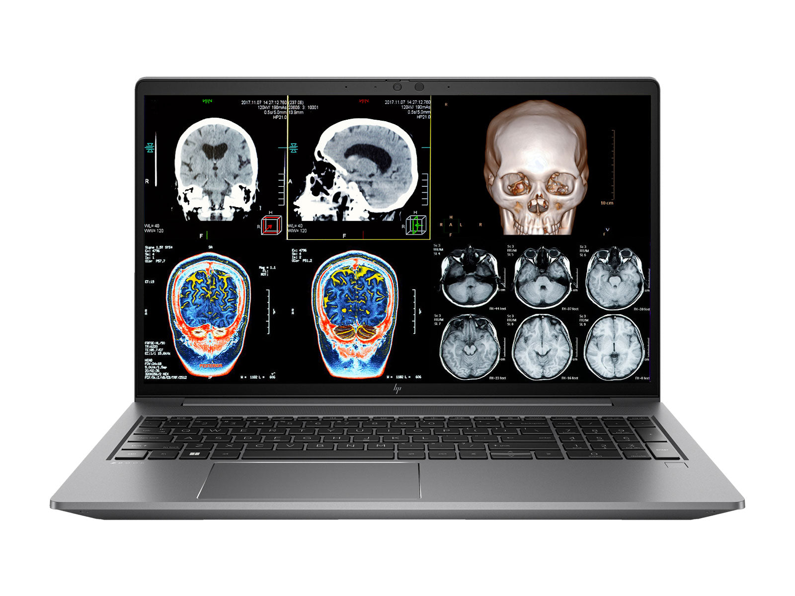 HP ZBook Power G10 Mobile Workstation | 15.6" FHD DICOM Calibrated | Intel i7-13800H @ 5.20GHz | 14-Core | 32GB DDR5 | 512GB NVMe SSD | NVIDIA RTX A500 4GB