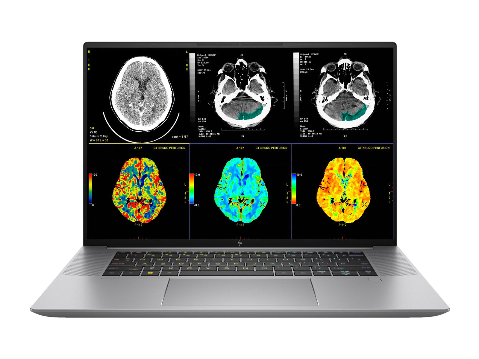 HP ZBook Studio 16 G10 Mobile Radiology Workstation | 16" WQUXGA 8MP+ DICOM Calibrated | Core i7-13800H @ 5.2GHz | 64GB DDR5 | 512GB NVMe SSD | NVIDIA RTX A1000 6GB | Win11 Pro