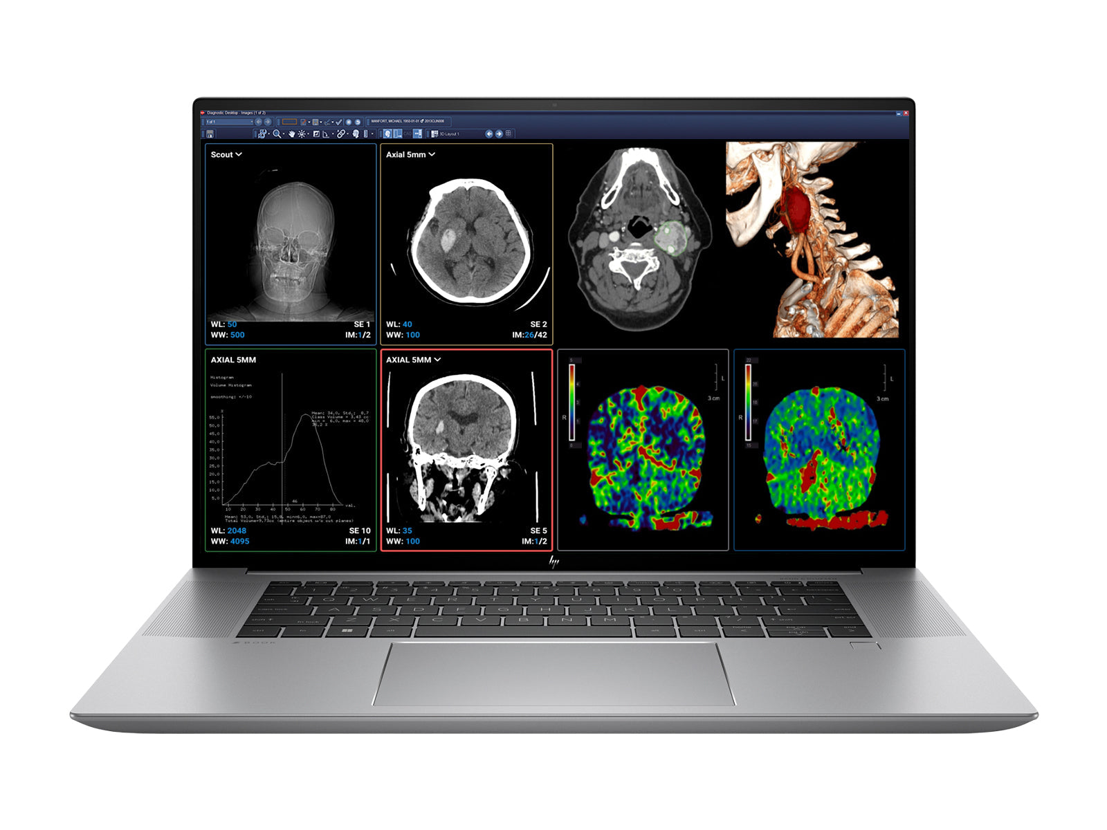 HP ZBook Studio 16 G9 Mobile Radiology Workstation | 16" WUXGA DICOM Calibrated | Core i7-12700H @ 4.70GHz | 14-core | 64GB DDR5 | 1TB NVMe SSD | Intel Iris Xe 4GB | WiFi 6