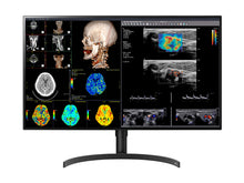 LG 8MP Fusione 4K 32 "Colore Diagnostic Radiology Monitor 450 CD/M² DICOM Luminosità (32HL512D)