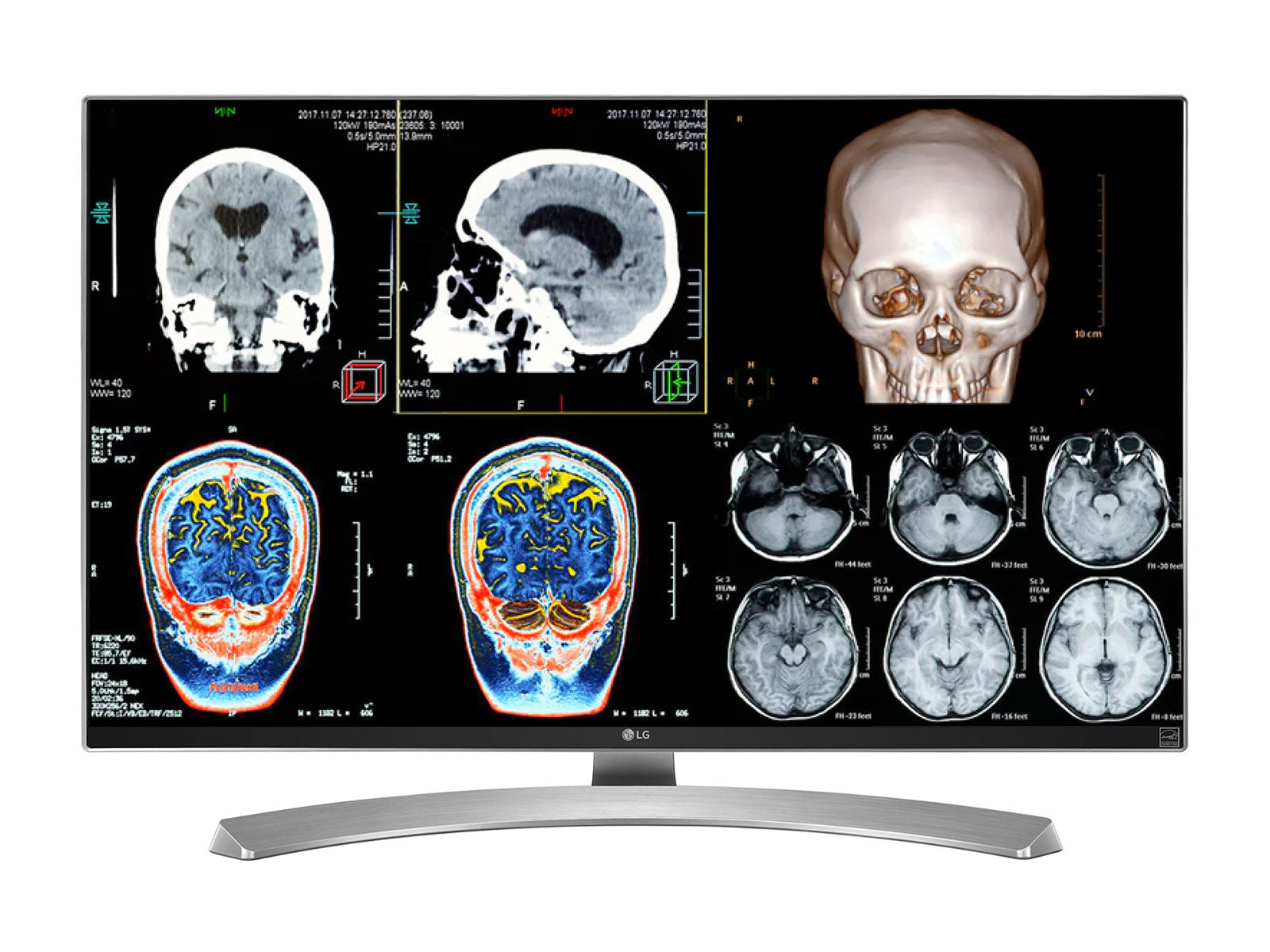 LG 27" 8MP Color Clinical Review Medical Display Monitor (27M-W)