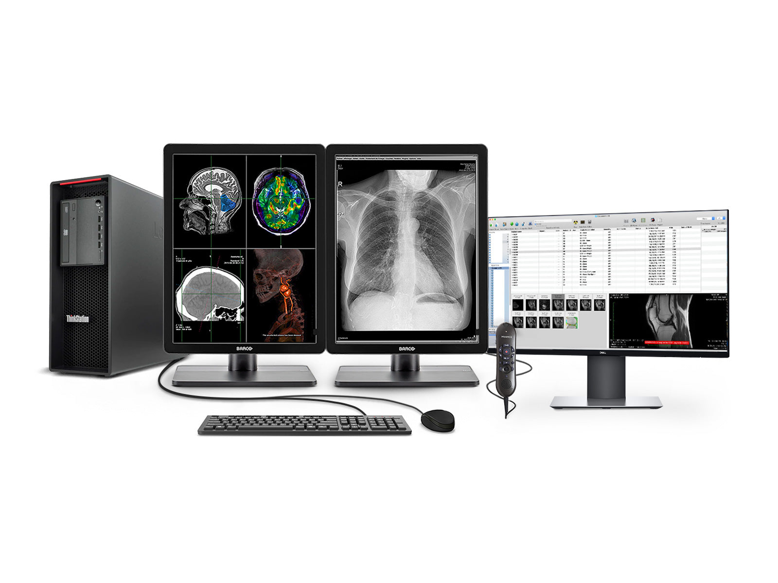 Complete PACS General Radiology Station | Barco 3MP Color LED Displays | Lenovo Workstation | Dictation Mic | Worklist Monitor (3321Z4R)