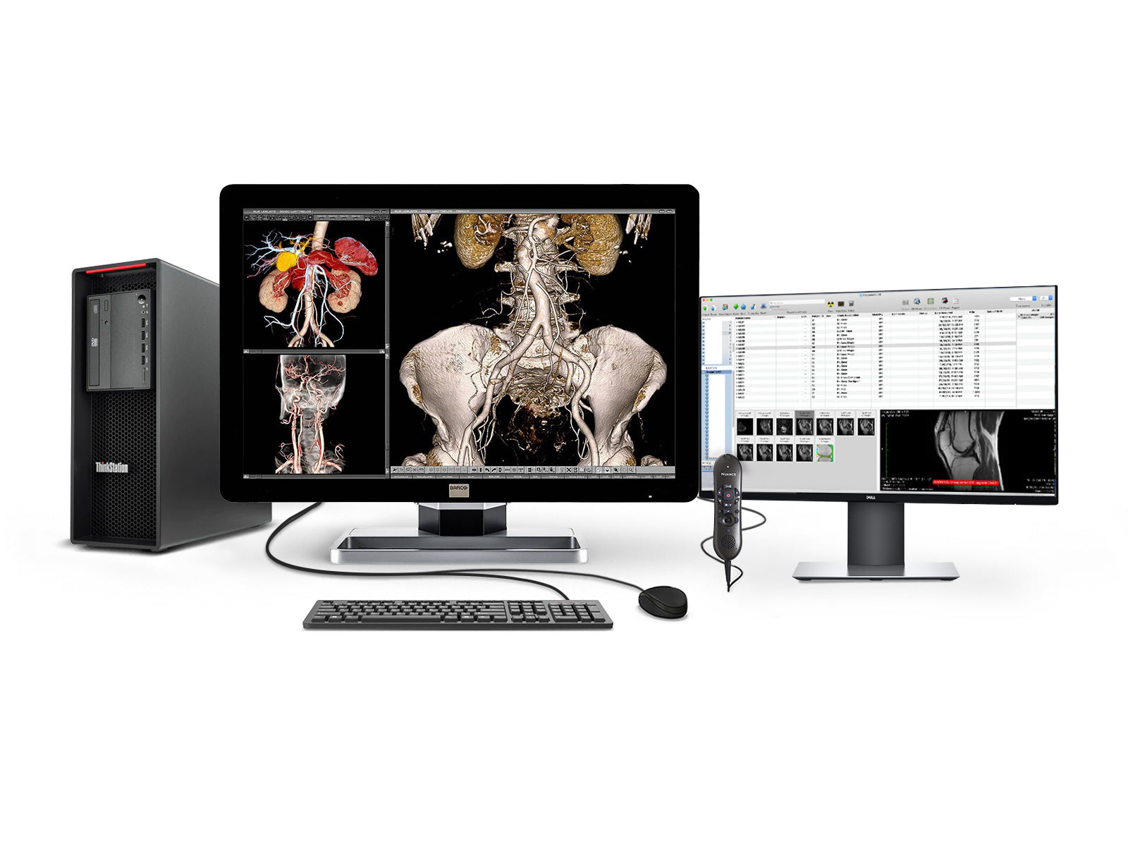 Complete PACS General Radiology Station | Barco 6MP Color LED Display | Lenovo Workstation | Dictation Mic | Worklist Monitor (6230Z4R)