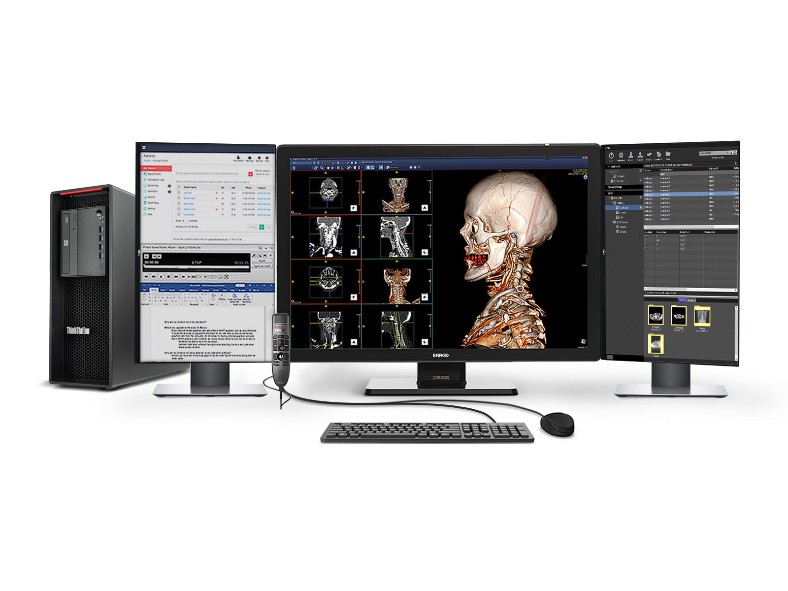 Complete PACS General Radiology Station | Barco Coronis MDCC-6530 6MP Color LED Display | Lenovo Workstation | Dictation Mic | Worklist Monitor (6530Z4R)