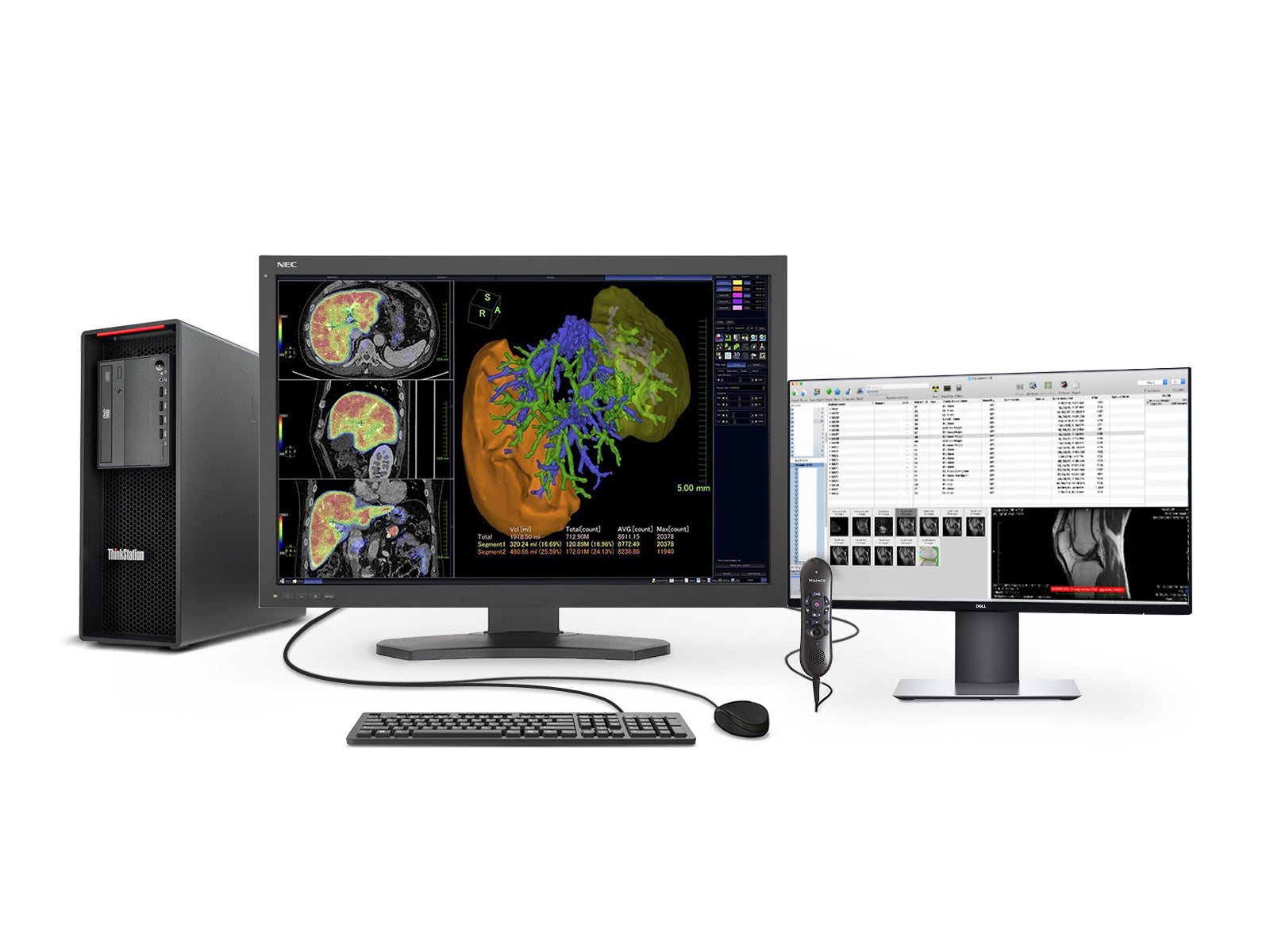 Complete PACS General Radiology Station | NEC 6MP Color LED Display | Lenovo Workstation | Dictation Mic | Worklist Monitor (MD302C6Z4)