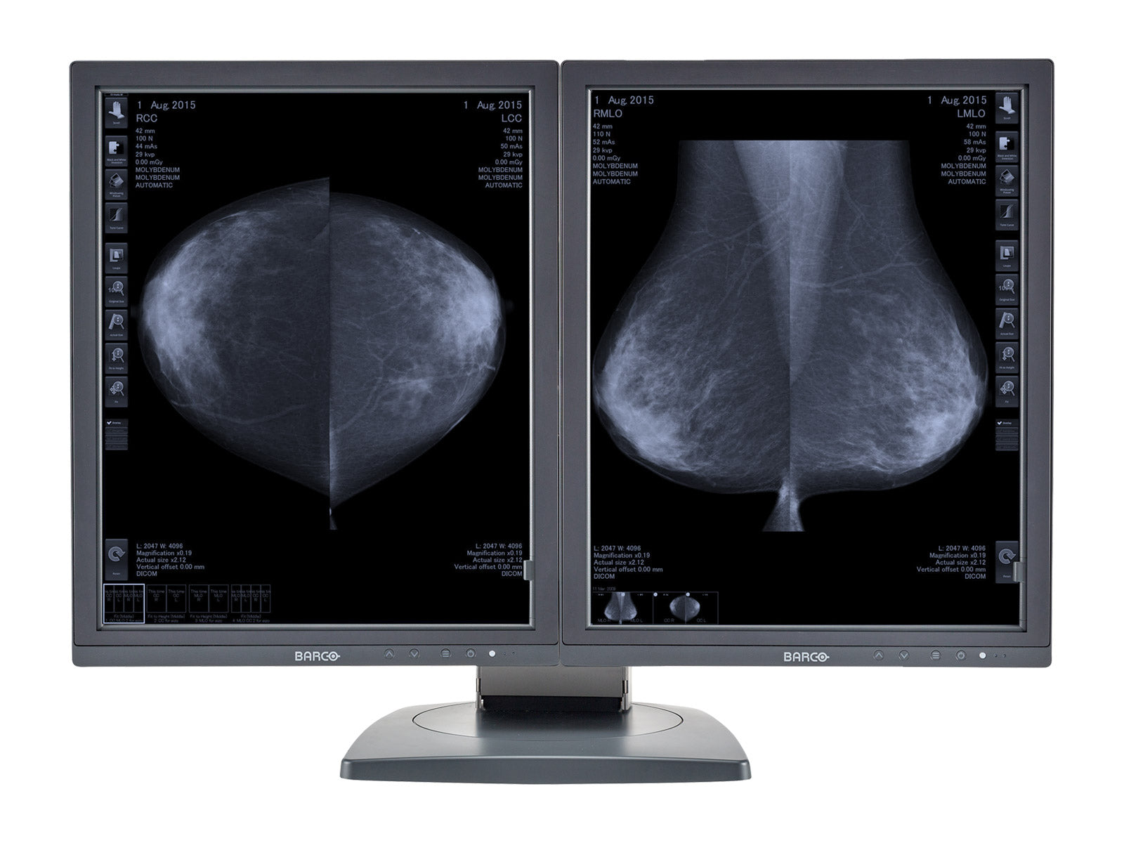 Complete Mammography Reading Station | Lenovo Workstation