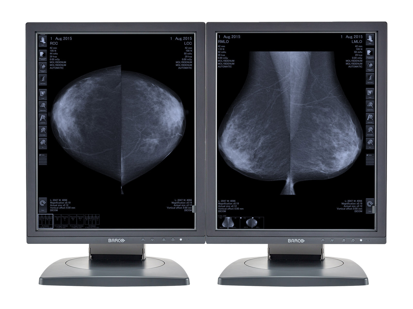 Barco Coronis MDCG-5121 5MP 21" Grayscale Mammo 3D-DBT Breast Imaging Display Monitor