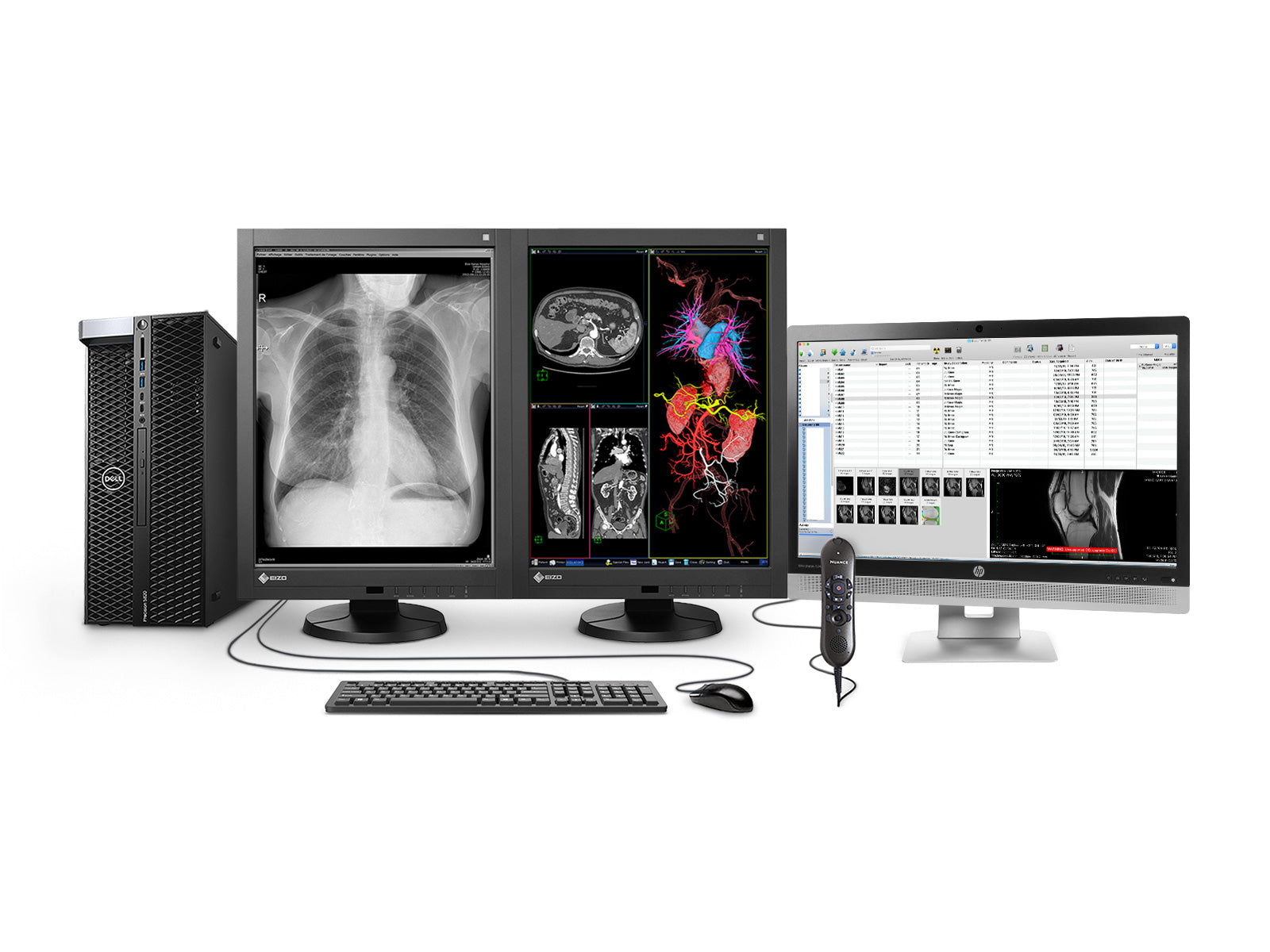 Complete PACS General Radiology Station | Eizo 3MP Color LED Displays | Dell Workstation | Dictation Mic | Worklist Monitor (RX340T5820R) Monitors.com 