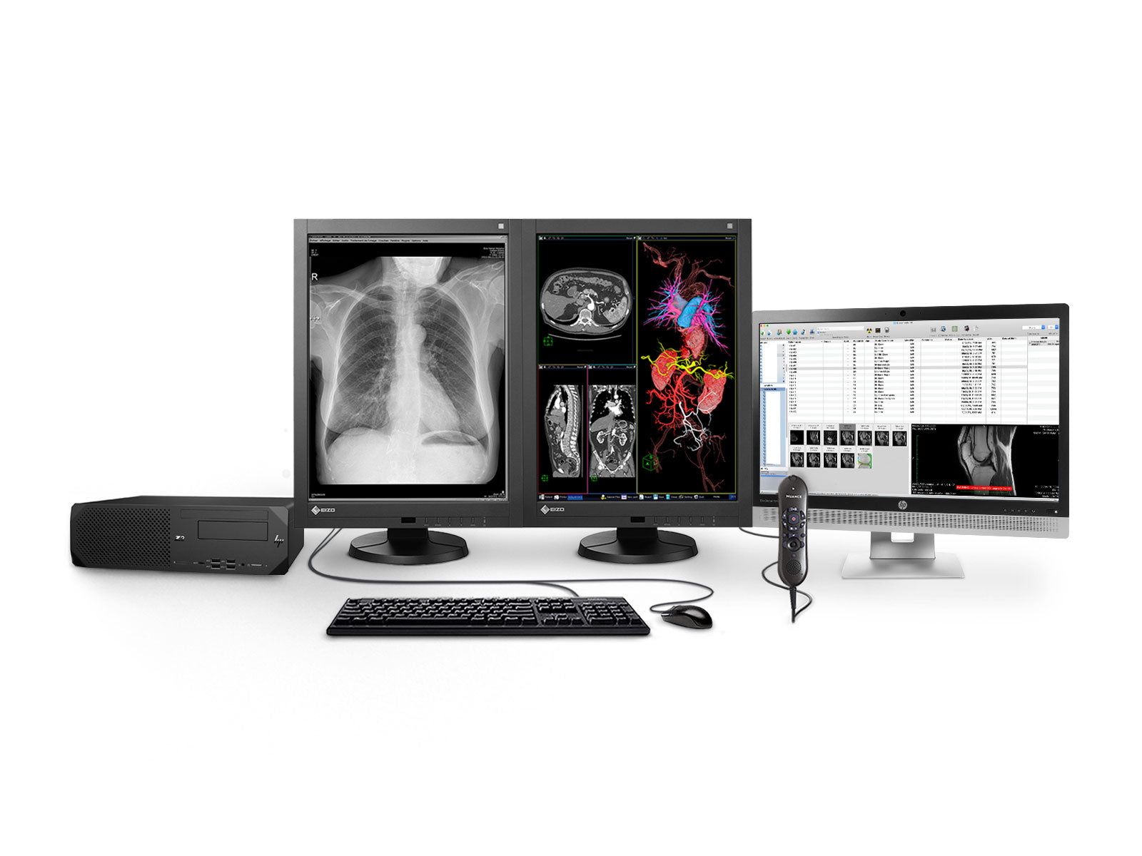 Complete PACS General Radiology Station | Eizo 3MP Color LED Displays | HP Workstation | Dictation Mic | Worklist Monitor (RX340Z2R) Monitors.com 