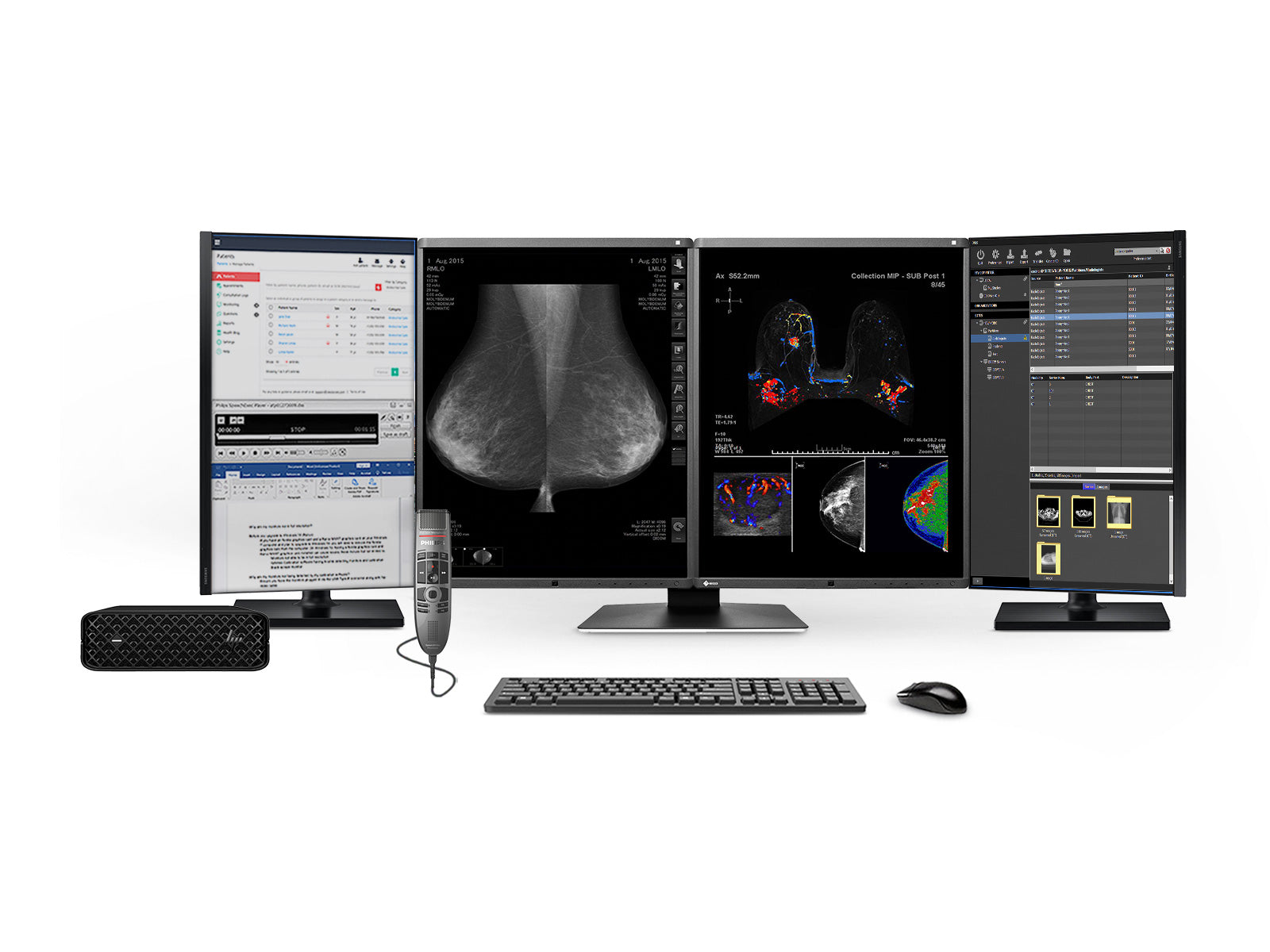 Complete Mammography Reading Station | Eizo RX570 5MP Monitors