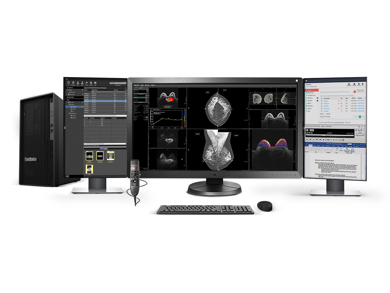 Complete PACS Mammography Reading Station Setup