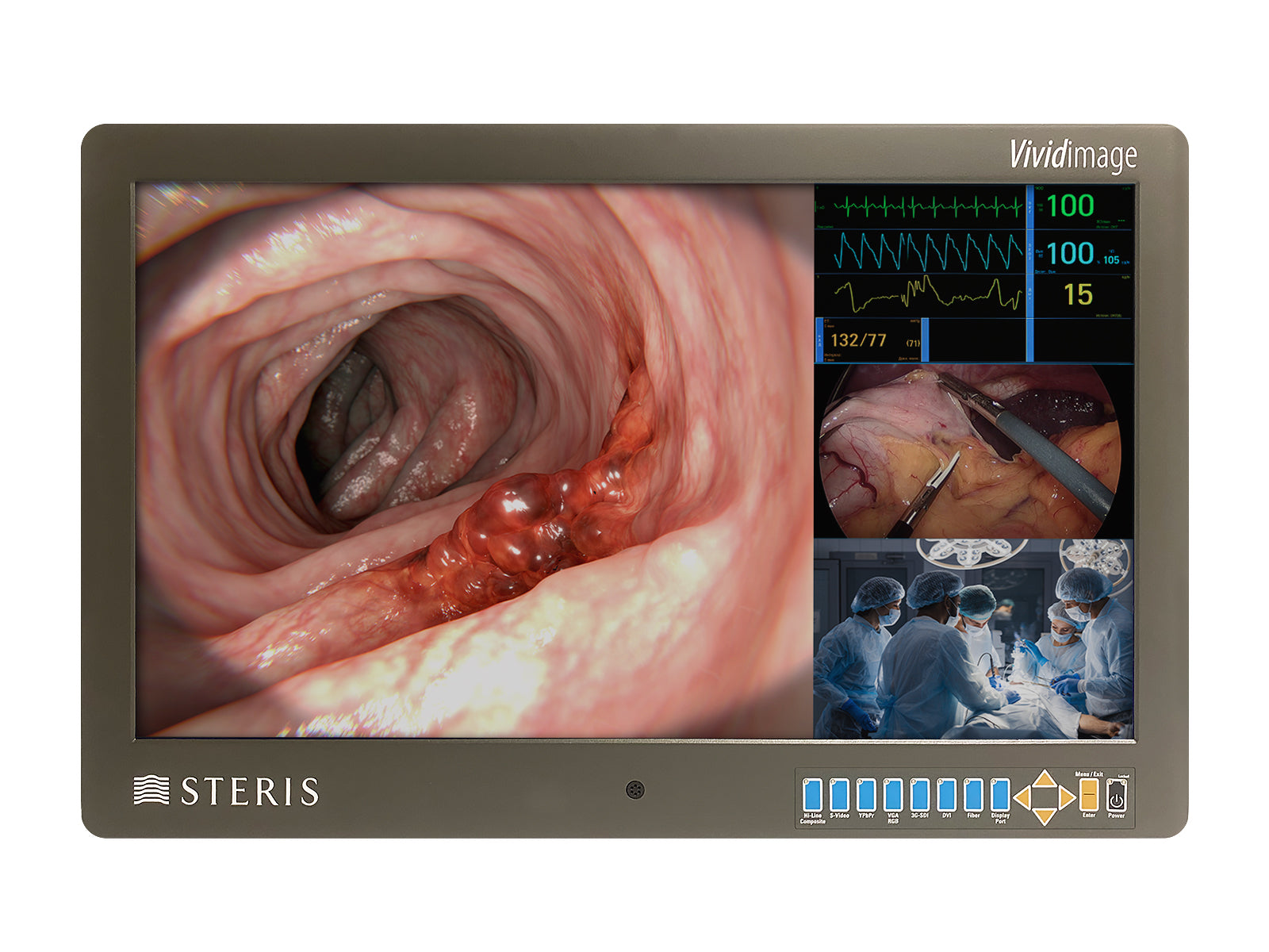 Steris Vividimage STERIS-27-HDD-R 27" Color Surgical Display Monitor (RLM27HDNPWR) Monitors.com 