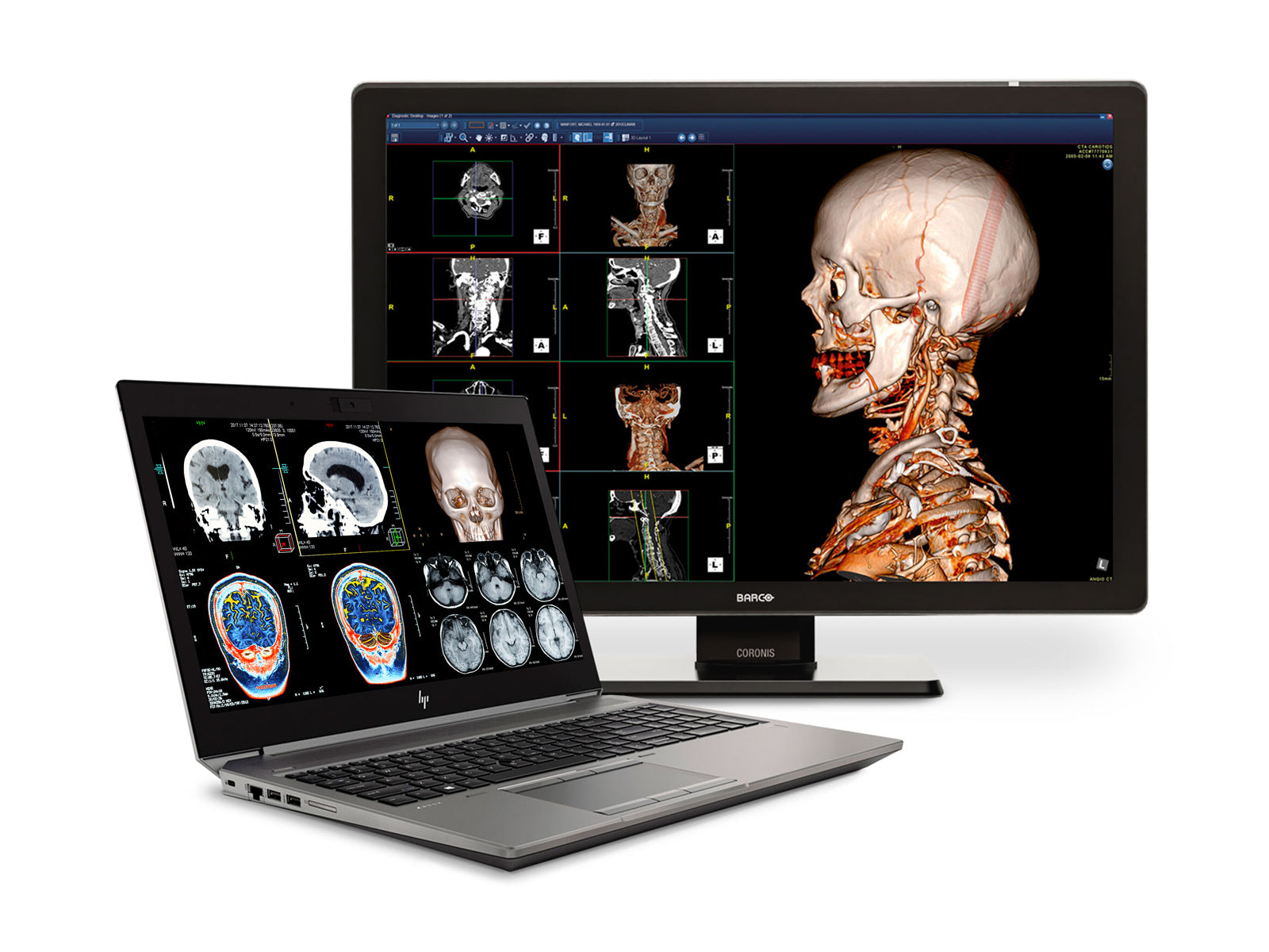 HP ZBook 15 G6 Mobile Radiology Workstation | 15.6" 8MP UHD DICOM Calibrated | Core i7-9850H @ 4.60GHz | 64GB DDR4 | 512GB NVMe SSD | NVIDIA Quadro RTX 3000 6GB | Win10 Pro