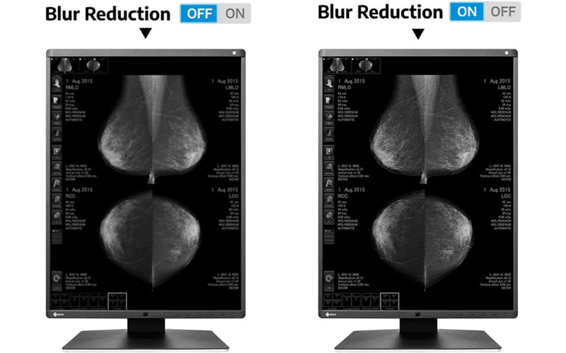 Blur Reduction