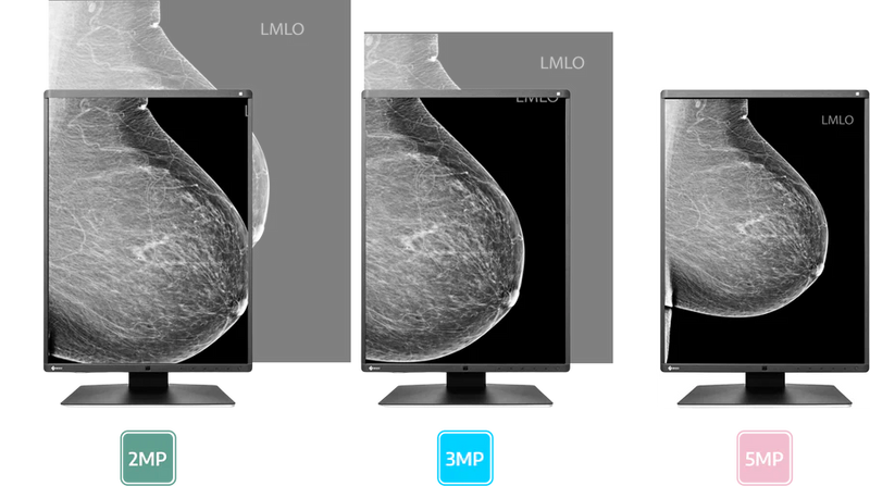 Excellent Image Quality For Ultra-Sharp Details