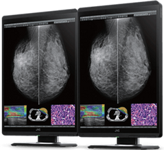 Mammography Displays