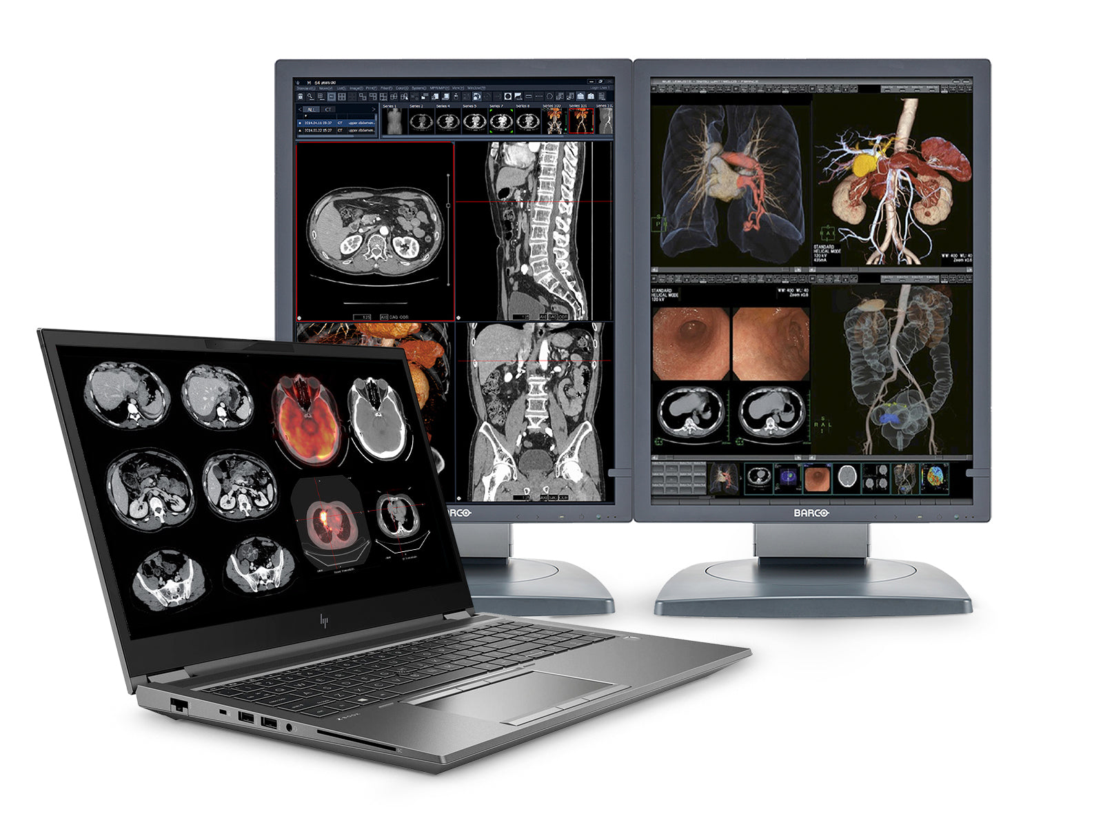 HP ZBook Fury 17 G8 Mobile Radiology Workstation | 17.3" FHD DICOM Calibrated | Core i9-11950H @ 5.0GHz | 64GB DDR4 | 1TB NVMe SSD | RTX A5000 16GB | Win10-11 Pro Monitors.com 