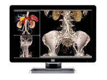 Barco Coronis Fusion MDCC-4330 4MP 30 "Kleur LED General Radiology PACS Display