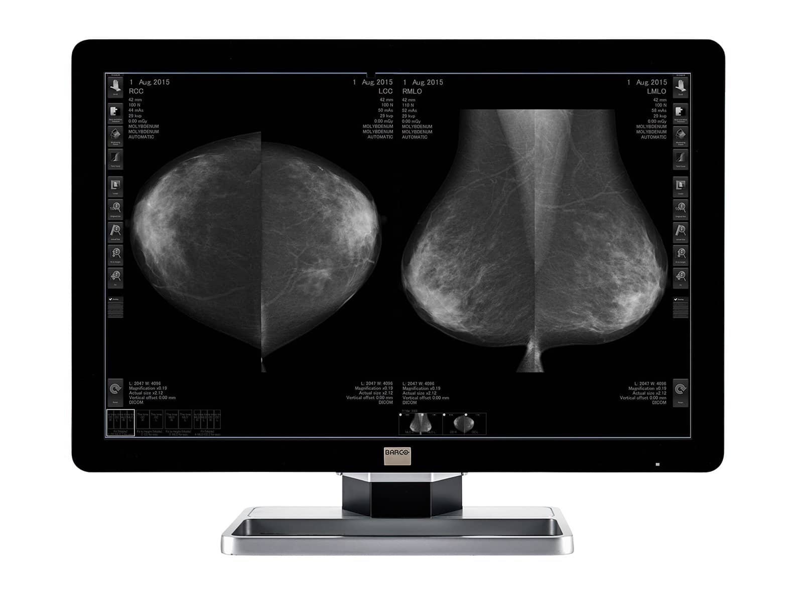 Barco Coronis Fusion MDCG-10130 10MP 30" Grayscale Mammo 3D-DBT Breast Imaging Display
