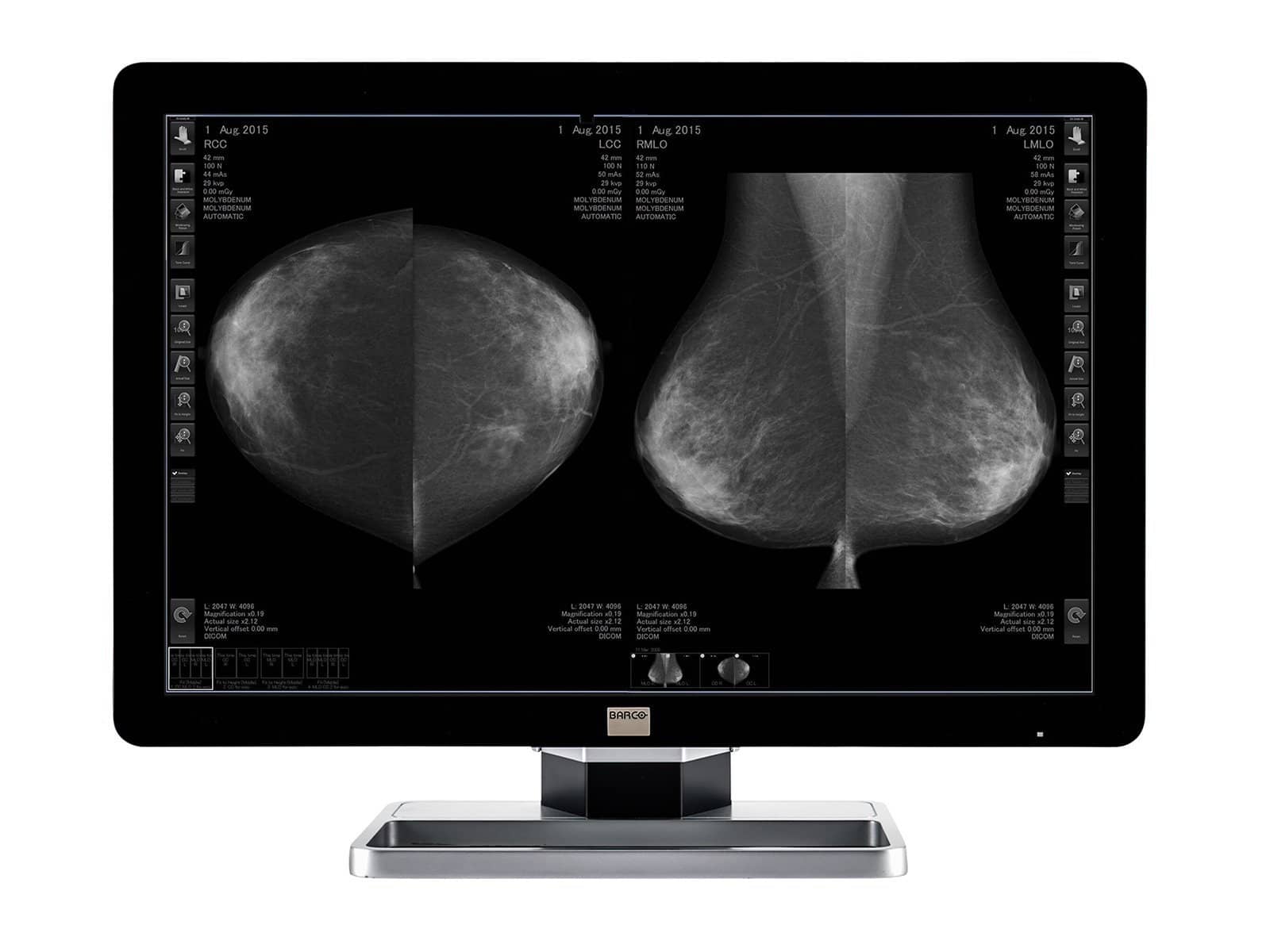 Barco Coronis Fusion MDCG-10130 Grayscale Mammo 3D-DBT Display (K9601618) Monitors.com 