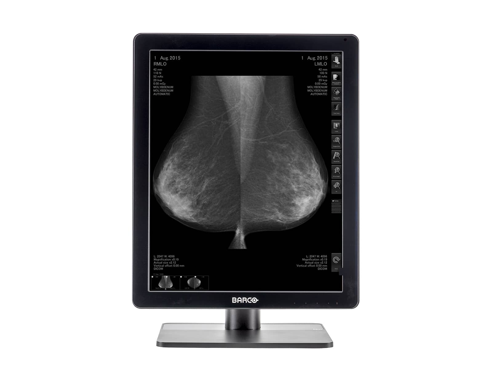 Barco Nio MDNG-5221 5MP 21" Grayscale LED 3D-DBT Mammography Breast Imaging PACS Display Monitors.com 