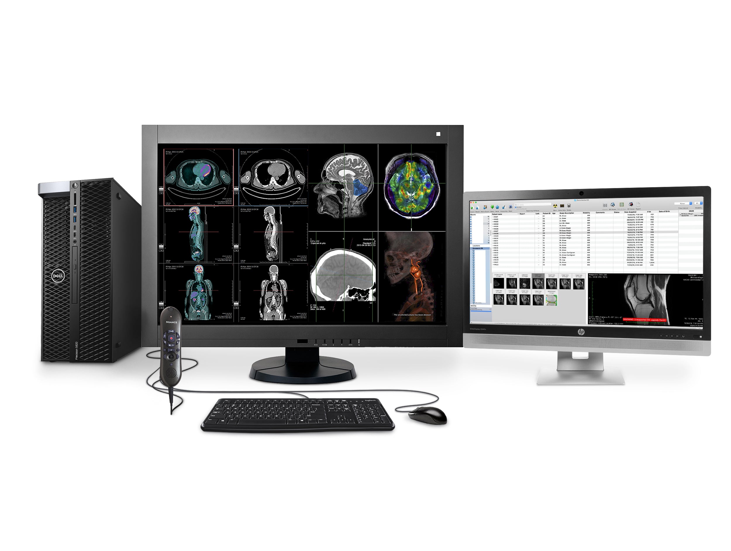 Complete PACS General Radiology Station | Eizo 4MP Color LED Displays | Dell Workstation | Dictation Mic | Worklist Monitor (RX4405820) Monitors.com 