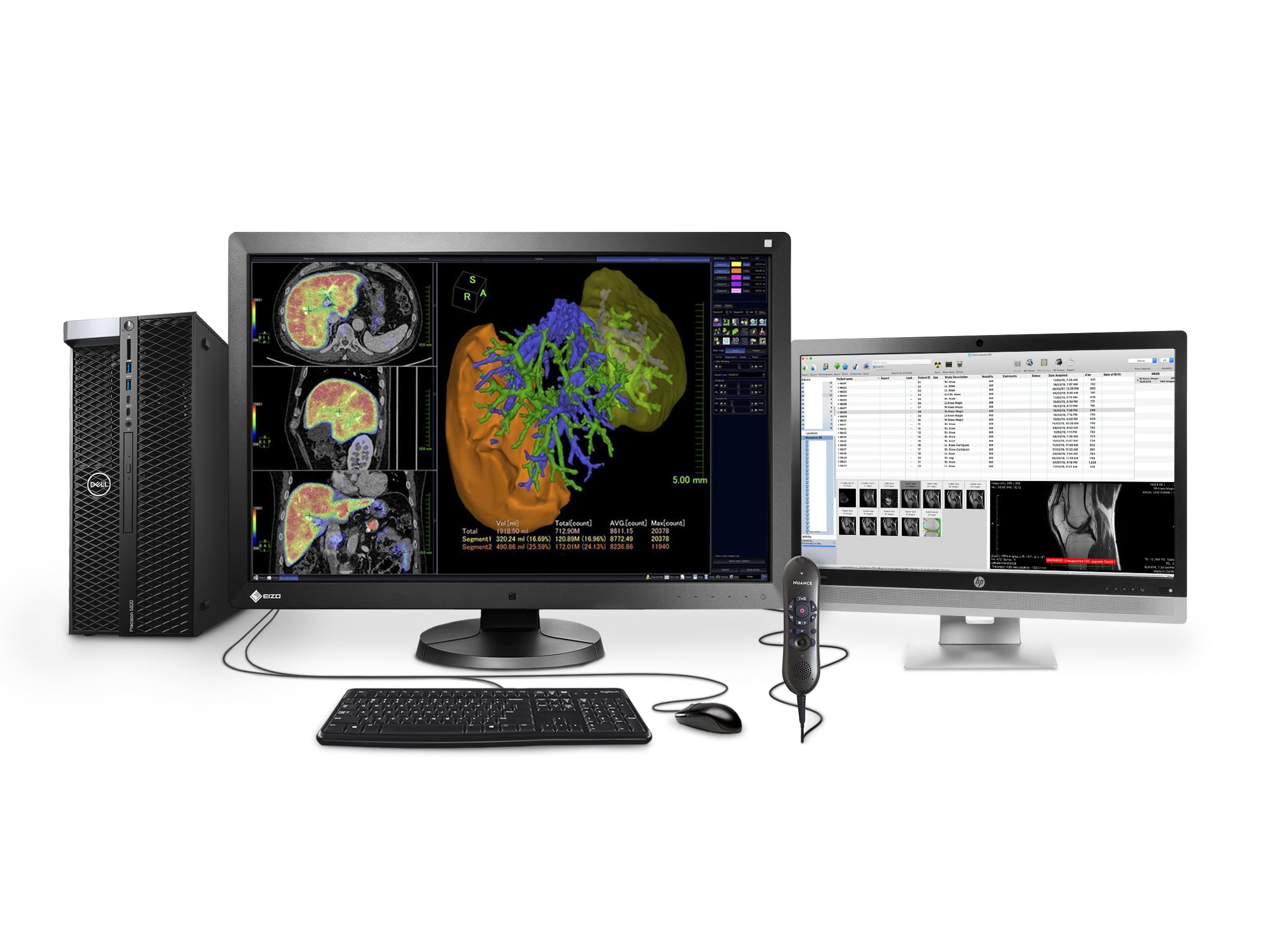 Complete PACS General Radiology Station | Eizo 6MP Color LED Displays | Dell Workstation | Dictation Mic | Worklist Monitor (RX6505820R) Monitors.com 