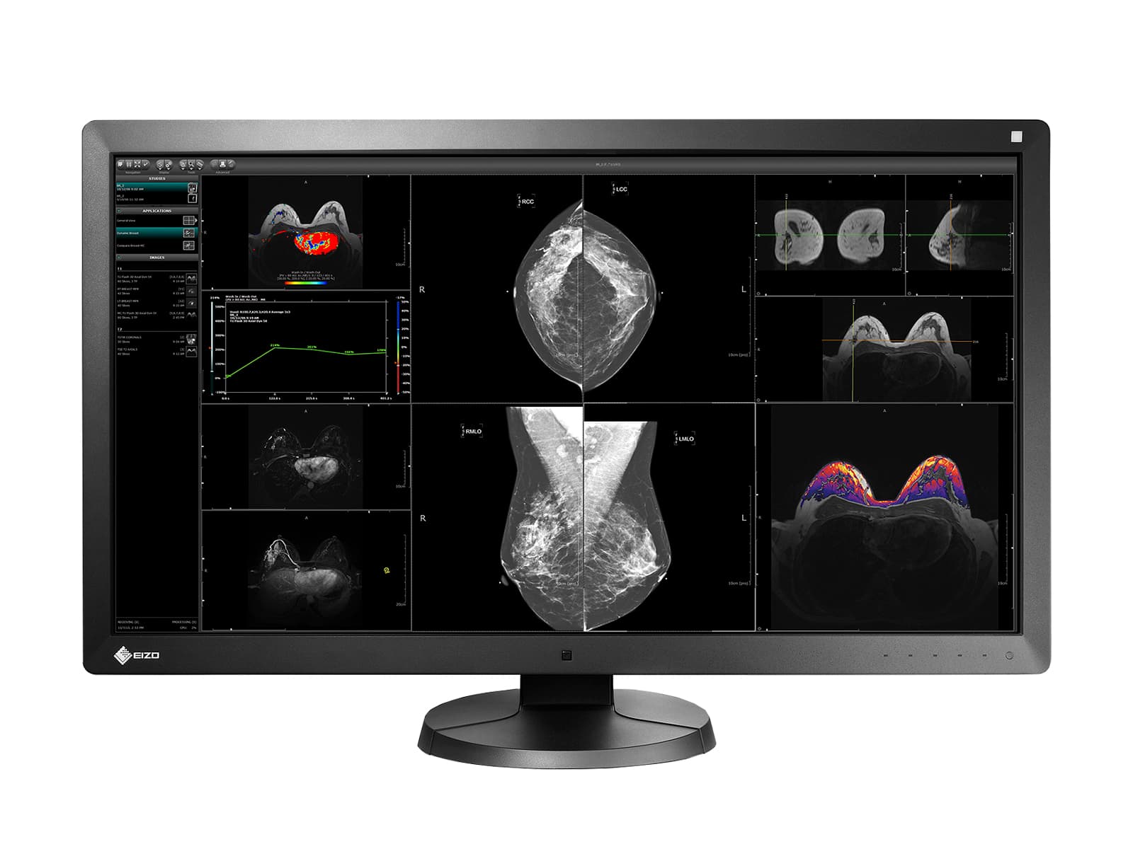 Eizo RadiForce RX850 8MP 31" Fusion kleur LED Mammo 3D-DBT borstbeeldvorming-scherm (RX850-BK)