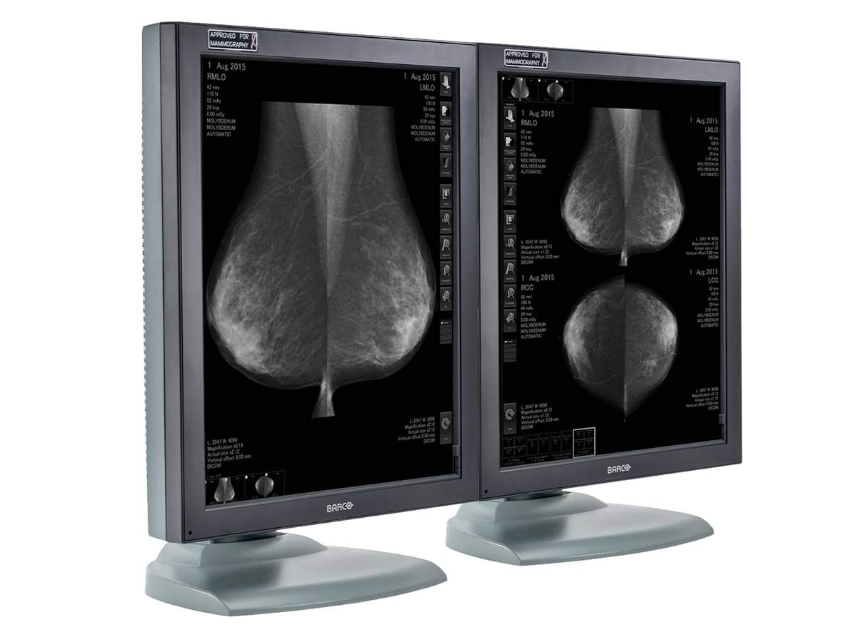 Complete Mammography Reading Station | Barco 5MP Grayscale Displays | Dell Workstation | Dictation Mic | Worklist Monitor (5121T5820R) Monitors.com 